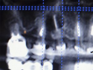 caso-cirugia-1-2