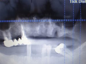 caso-cirugia-2-1