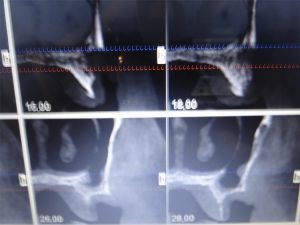caso-cirugia-2-2