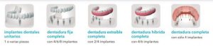 generalidades