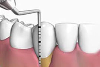 Smiling senior woman with new dental implants sitting in the dental office and looking at the mirror