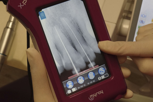 Smiling senior woman with new dental implants sitting in the dental office and looking at the mirror