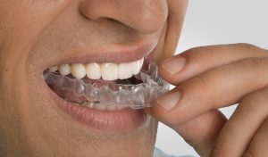 ortodoncia invisalign León