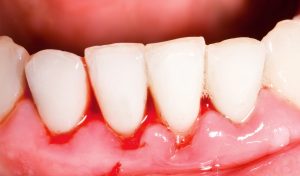 urgencias dentales en León
