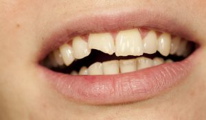 urgencias dentales en León